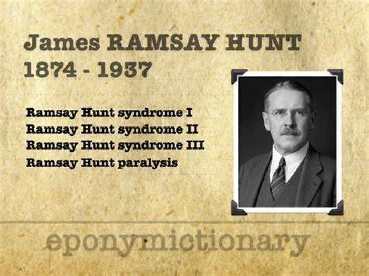 My Battle with Ramsay Hunt Syndrome (The First Year)