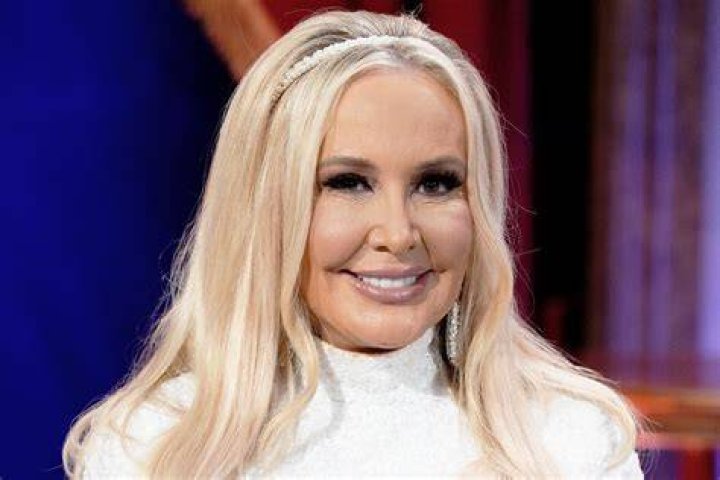 Shannon Storms Beador Gets Filler, "Can't Recognize" Her Face The